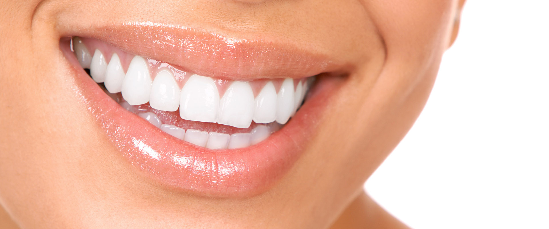 At-home Professional Teeth Whitening - What is the Difference?