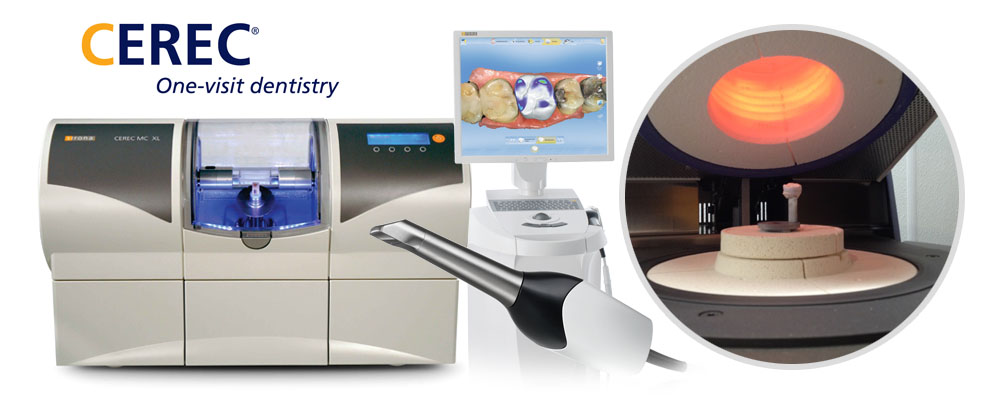 What Exactly is a CEREC Dental Implant?