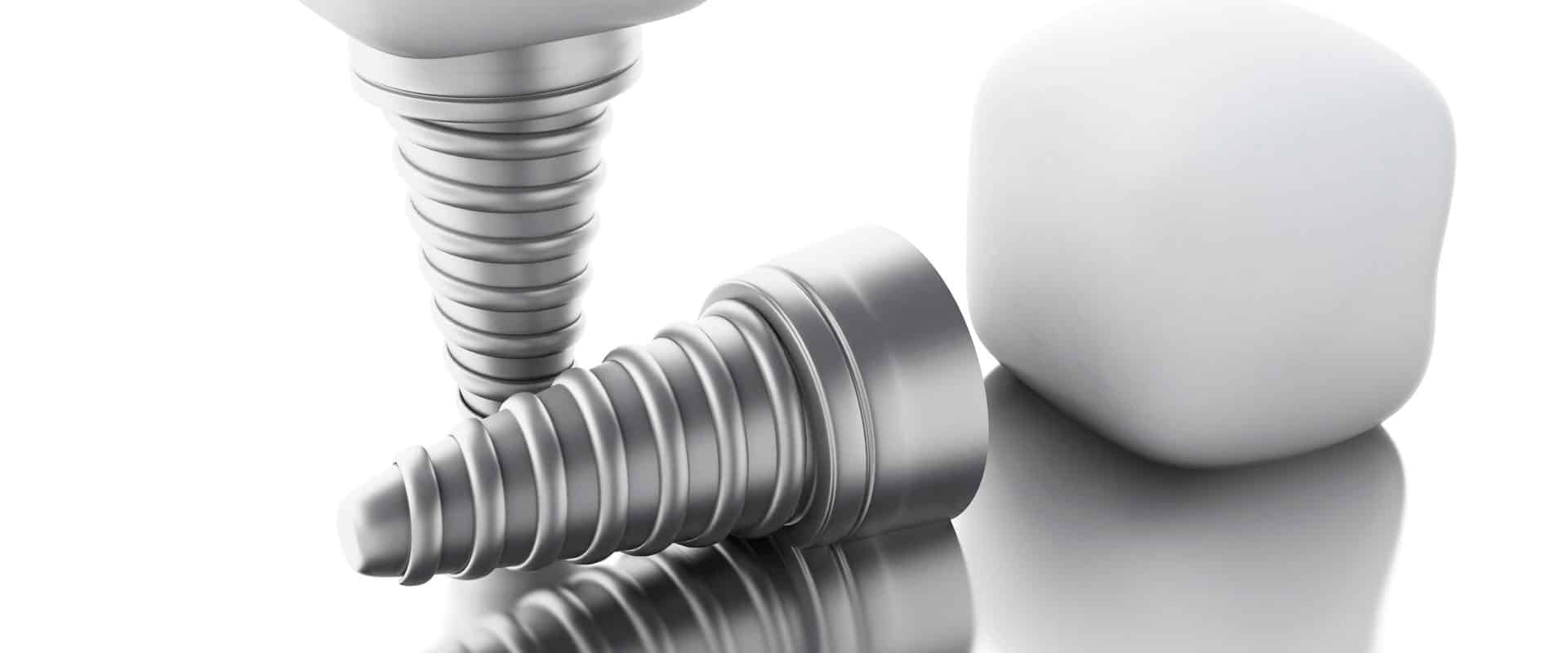 Are Dental Implants Right for You?