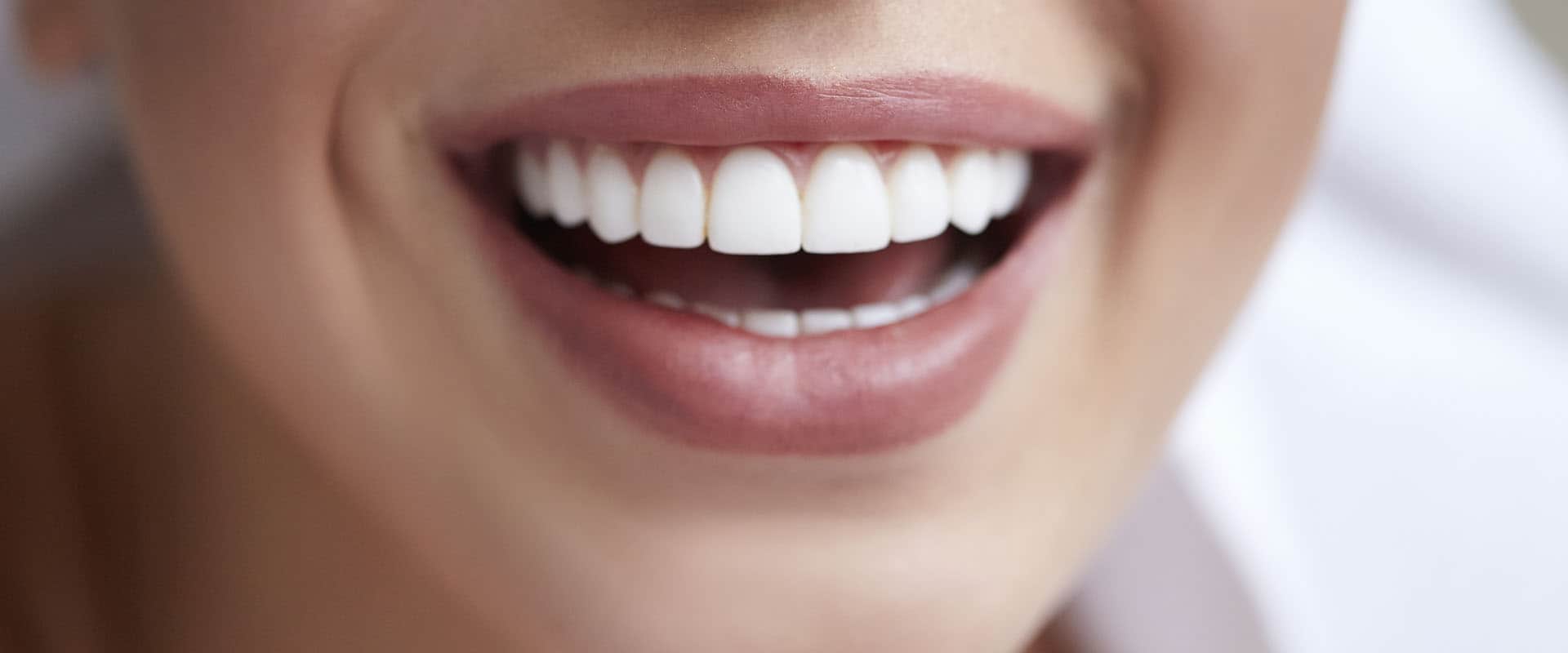 Can Getting Veneers Affect Oral Hygiene?