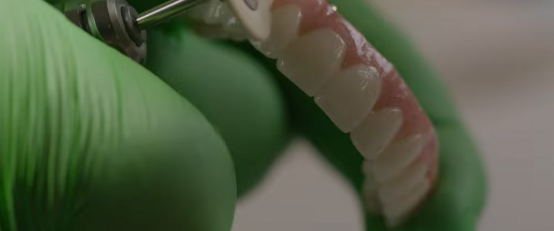 Implant-Supported Dentures: A More Secure Alternative to Traditional Dentures