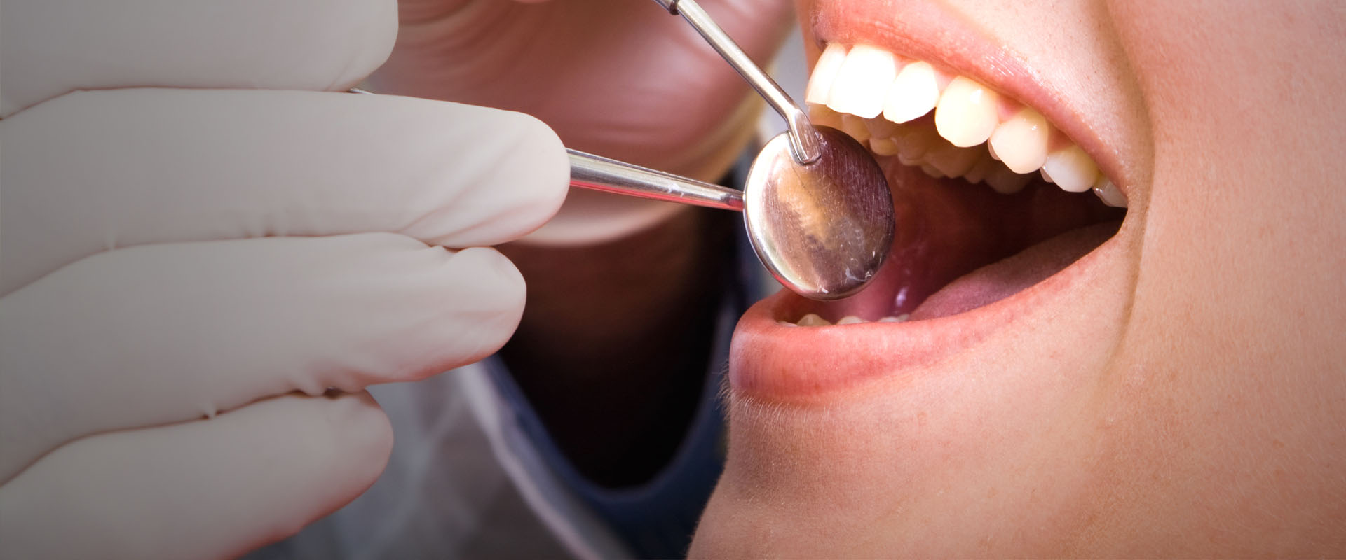 The Importance of Oral Cancer Screening 