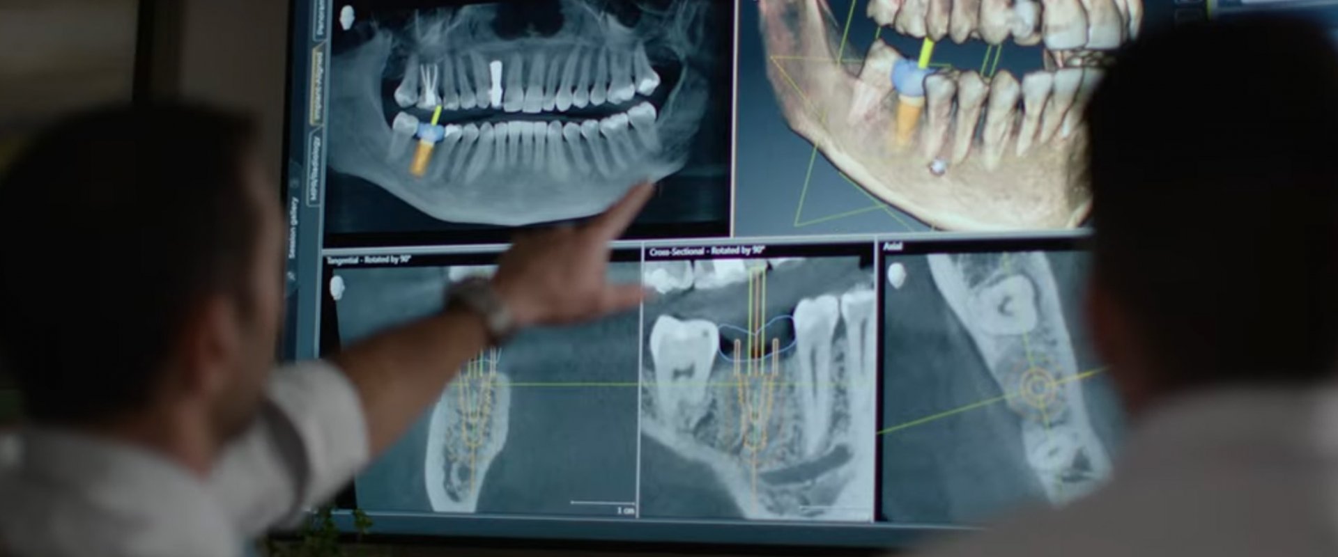 Root Canals Demystified: Separating Myth from Fact