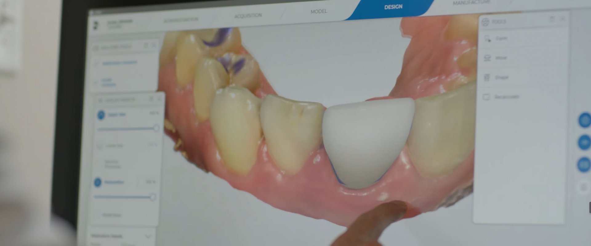 What Is a Prosthodontist - And Why Does It Matter Who Restores Your Smile?