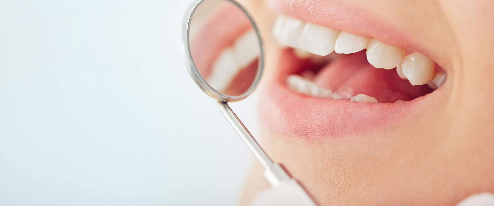 Can Fillings Look Like Your Natural Teeth? - TruCare Dentistry